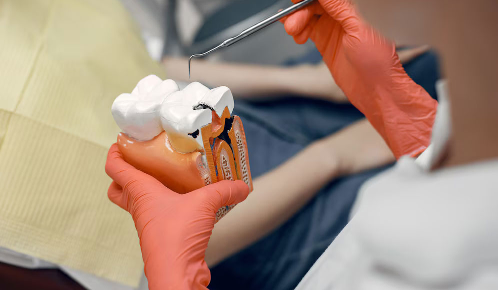 Pain Free Root Canals