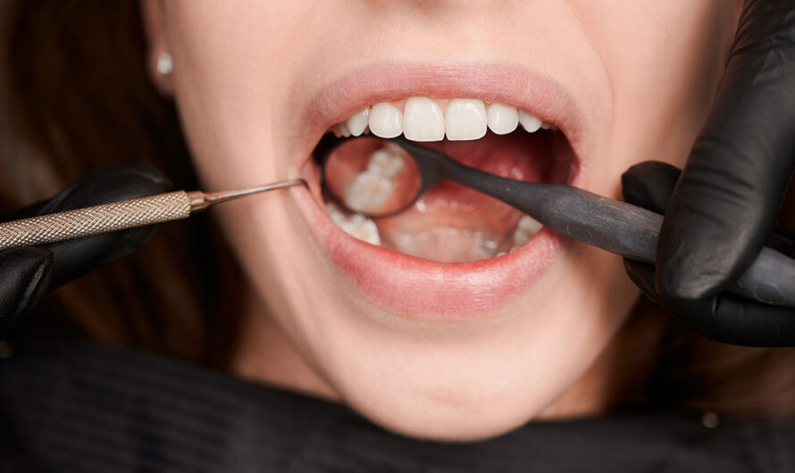 Aesthetic Fillings: Transforming Your Dental Health with Invisible Restorations
