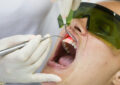 Laser Dental Treatment