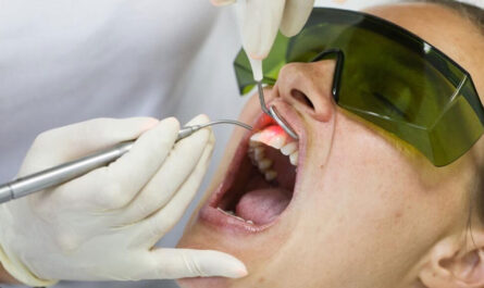 Laser Dental Treatment
