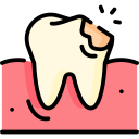 Tooth Decay or Cavities