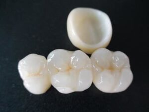 BruxZir Crowns
