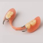 Partial Denture
