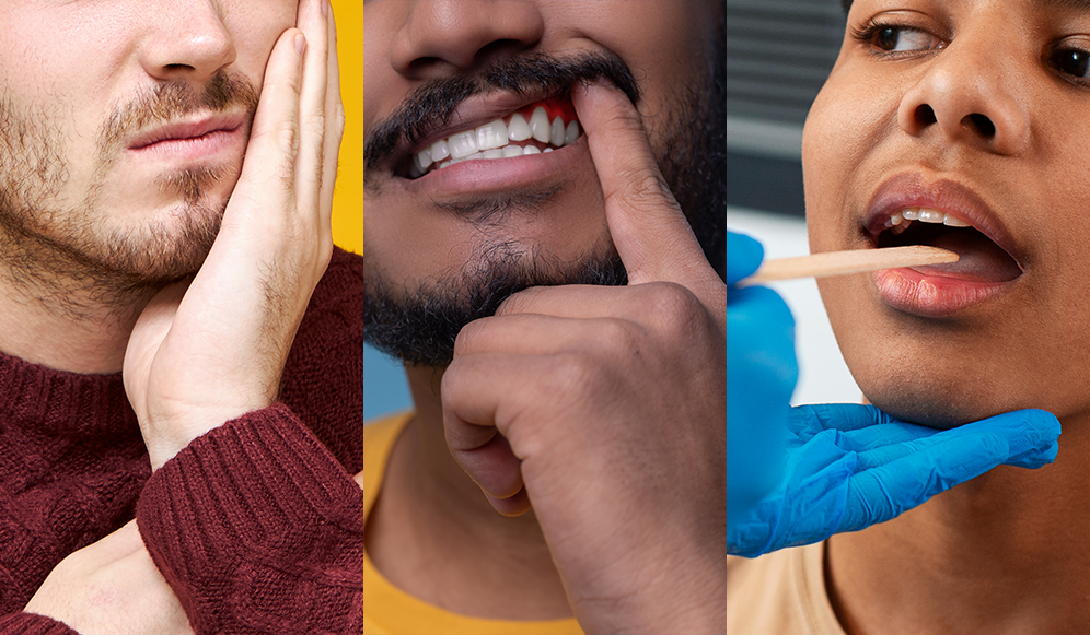 7 Signs You Need to See a Dentist Immediately