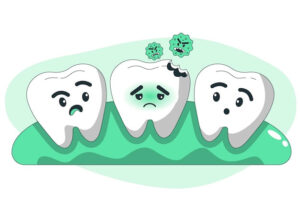 Think You Need a Full-Mouth Rehab? Answer These 5 Questions 4 tooth decay
