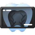 Does the sound of a dental drill make you anxious? 6 Digital X-Rays