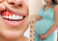 Bleeding Gums During Pregnancy