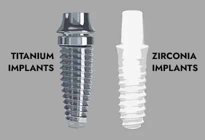 Titanium implants vs Zirconia implants