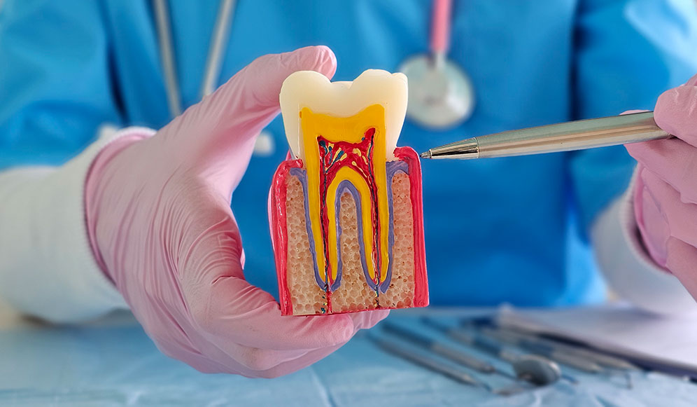 What Is Root Canal Treatment