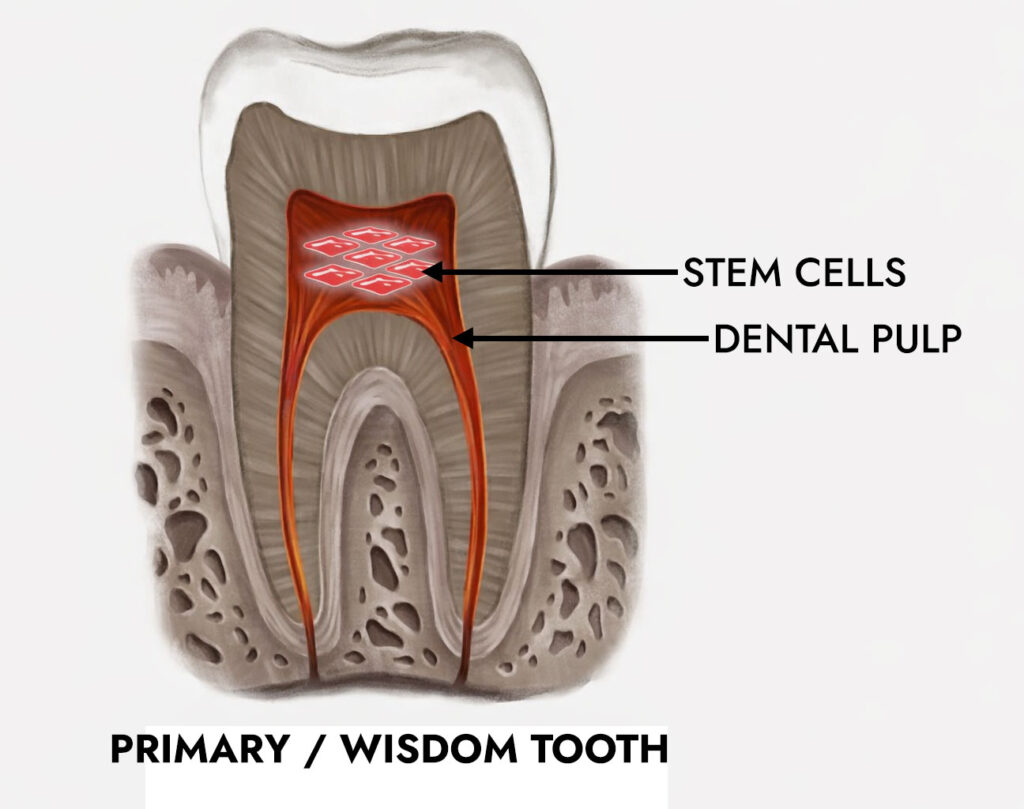 dental stem cell banking