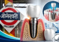 Dental Implants in Jogeshwari